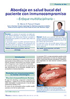 Abordaje en salud bucal del paciente con inmunocompromiso