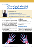 ¿Como afecta la obesidad a la Artritis Reumatoide? 